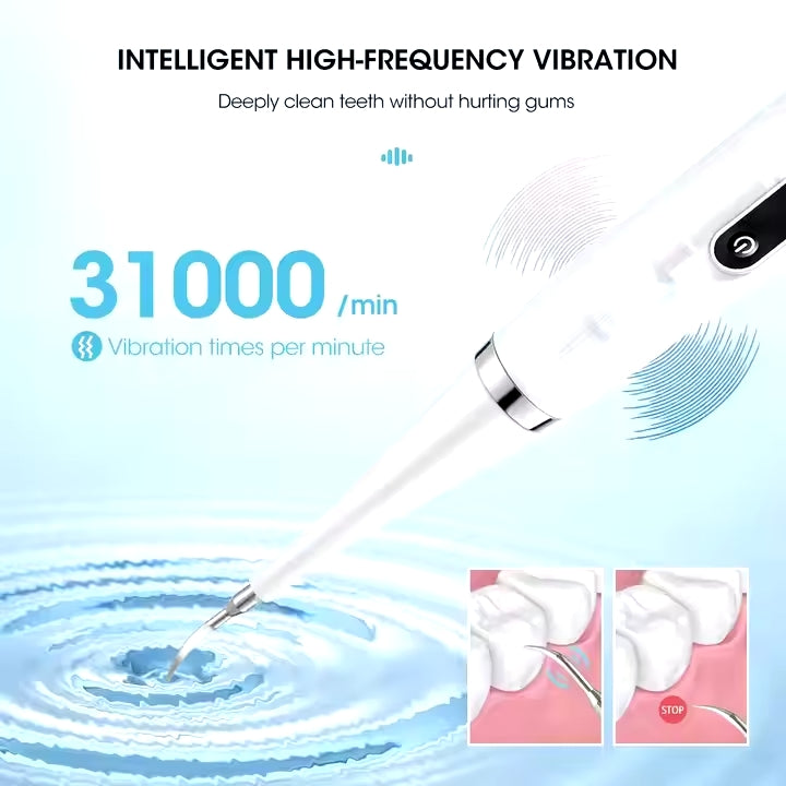 Tooth Cleaner Calculus Remover